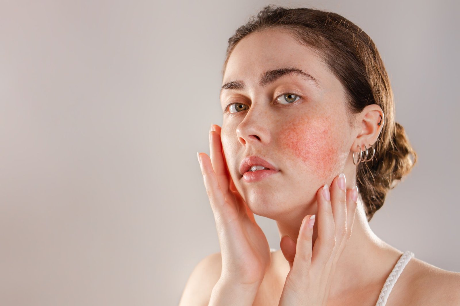 home remedies for redness on face