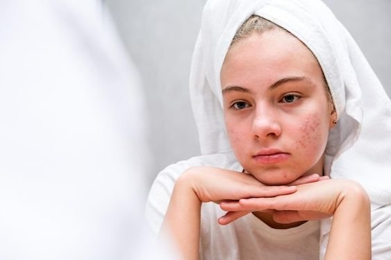 skincare routine for teenage girl